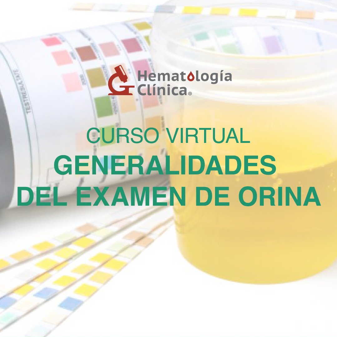 Mes Extra Generalidades Del Examen De Orina 3 Mayo 2023 Hematología Clínica Cursos En Línea 4865