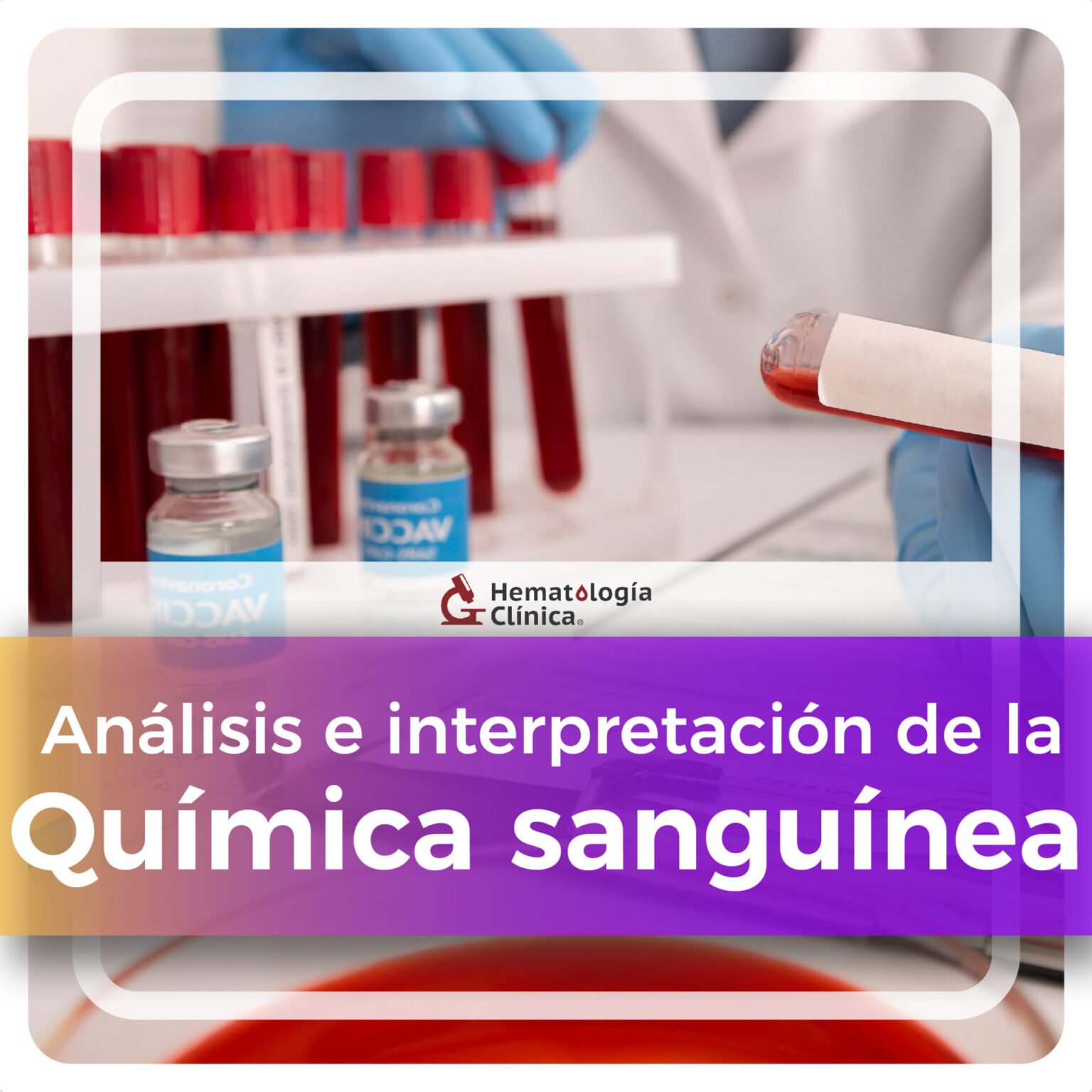 Análisis E Interpretación De La Química Sanguínea Septiembre 2024 Hematología Clínica Cursos 4238