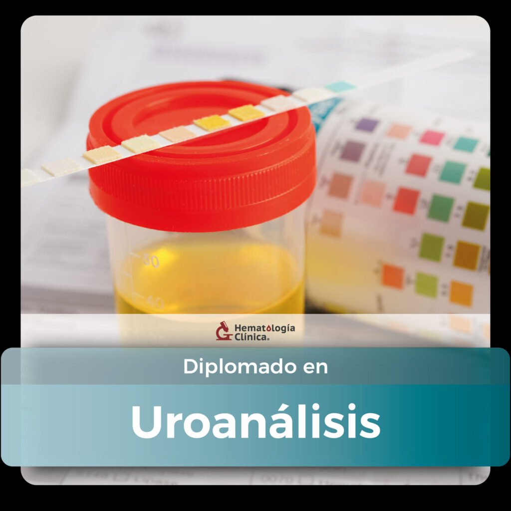 Estudia desde la formación de la orina, recolección de muestra, examen fisicoquímico y en el examen microscópico perfecciona tu habilidad para diferenciar todas las estructuras.