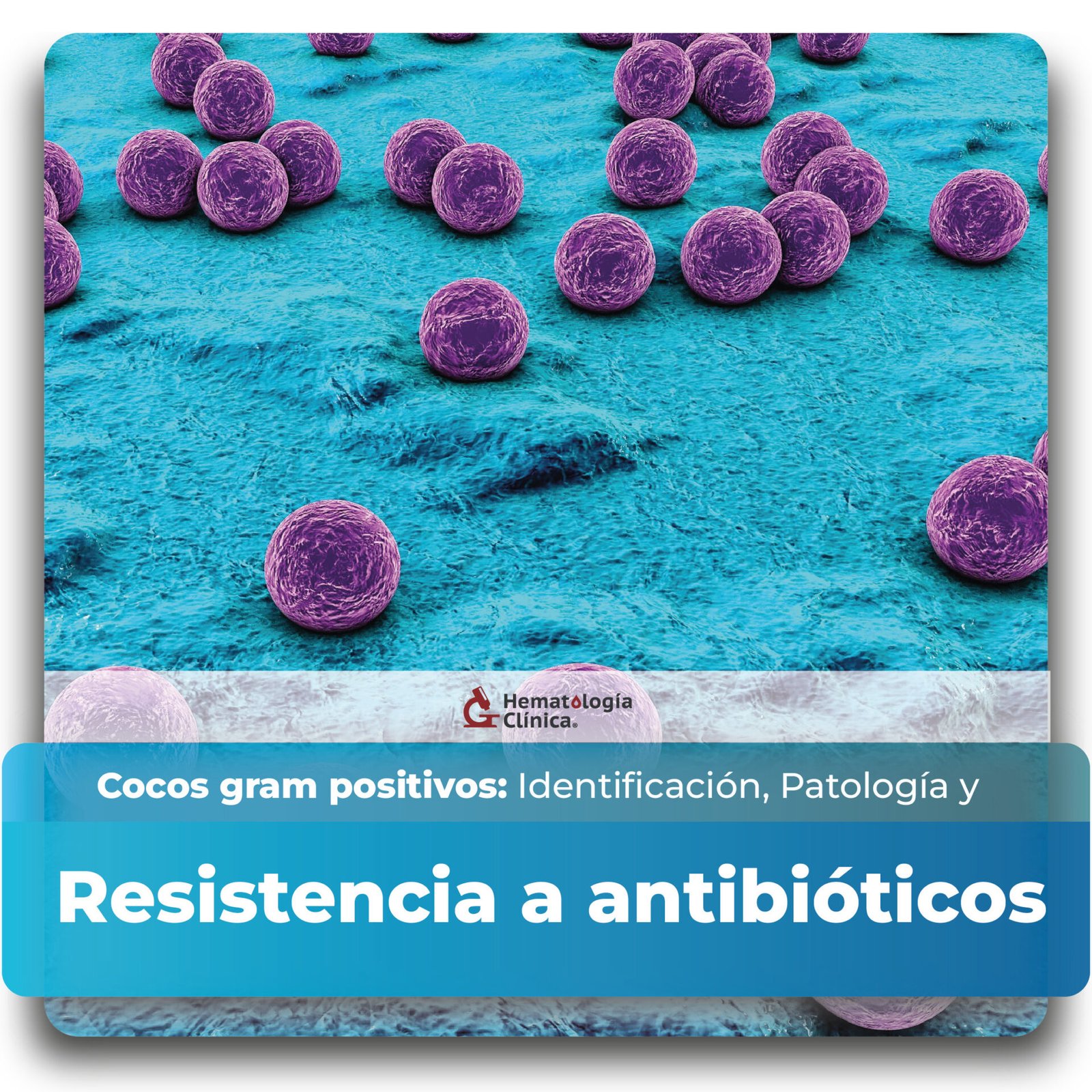 Cocos Gram positivos: Identificación, Patología y Resistencia a antibióticos (Junio 2025)
